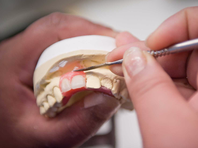 Protetik Diş Tedavisi