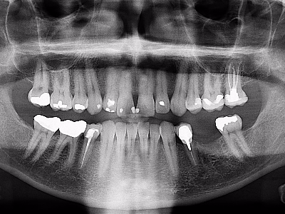 Panaromik Görüntüleme